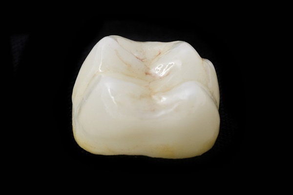 Dental Crown Placement: Front Vs Back Teeth