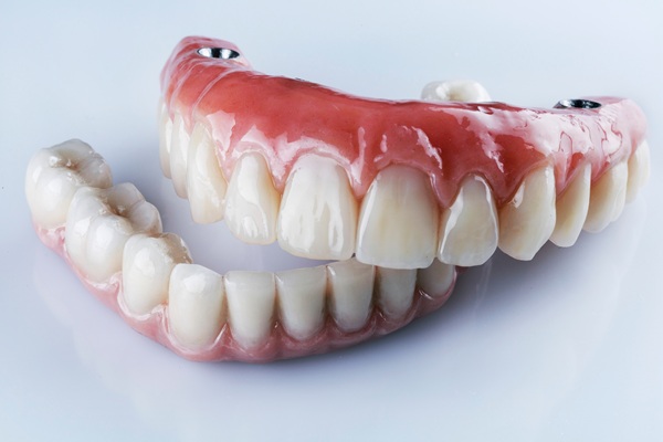 Care Tips For Implant Supported Dentures