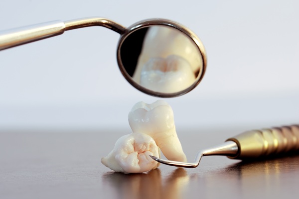 Complications To Watch For After A Tooth Extraction
